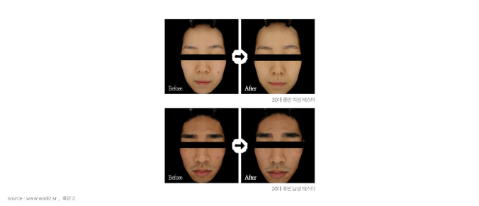 화장품 펀딩 비포 애프터